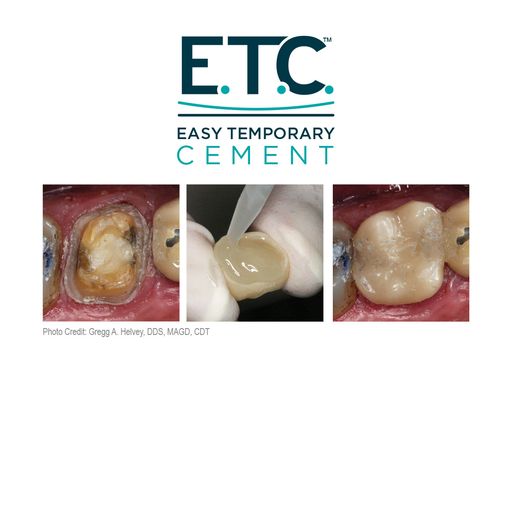 Parkell | E.T.C. Easy Temporary Cement (1mL-Syringe) | S255