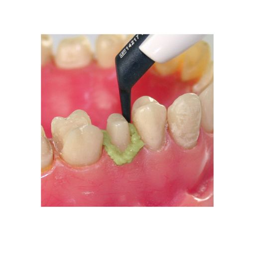 Parkell | Dryz Hemostatic Retraction Paste: 30 Capsules, 0.24g Each | S183