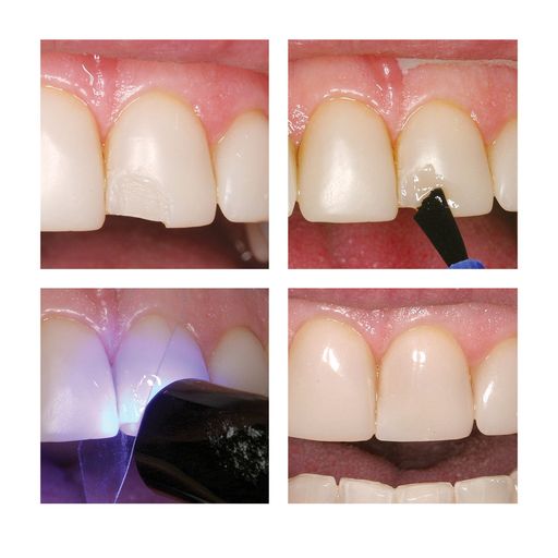 Parkell | Add&Bond Adhesive Composite Primer | S260