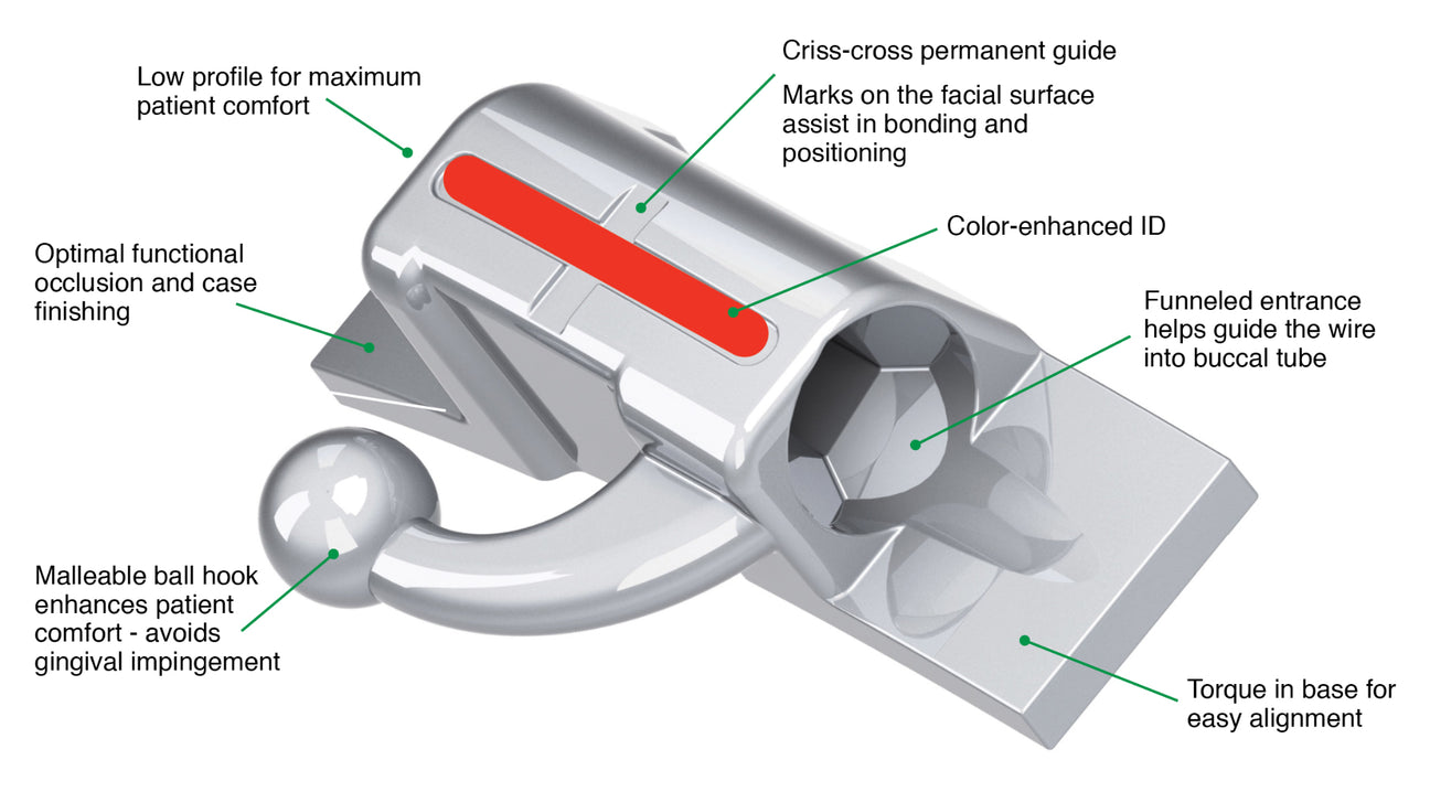 Brackets and Buccal Tubes