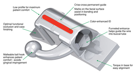 Brackets and Buccal Tubes