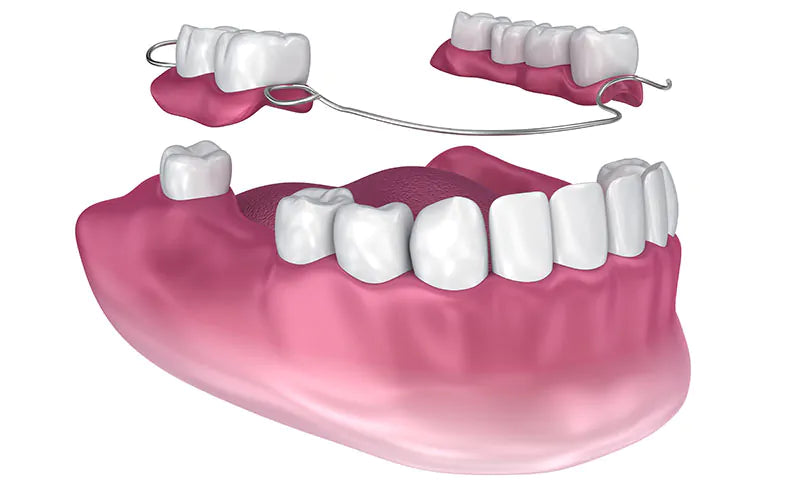 Dentures & Accessories