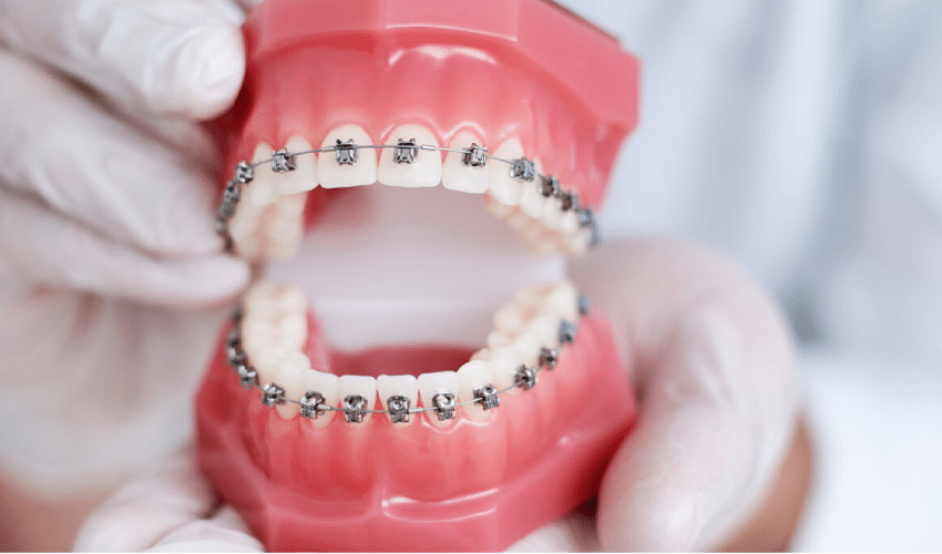 Orthodontics