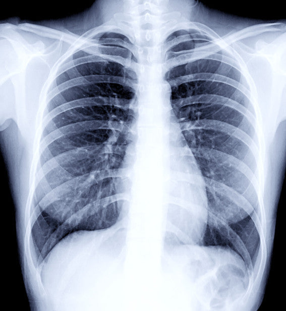 X-ray