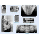 MARK3 | IntraOral Phosphor Imaging Plates by Mark3 | 100-7780